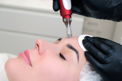 SkinPen